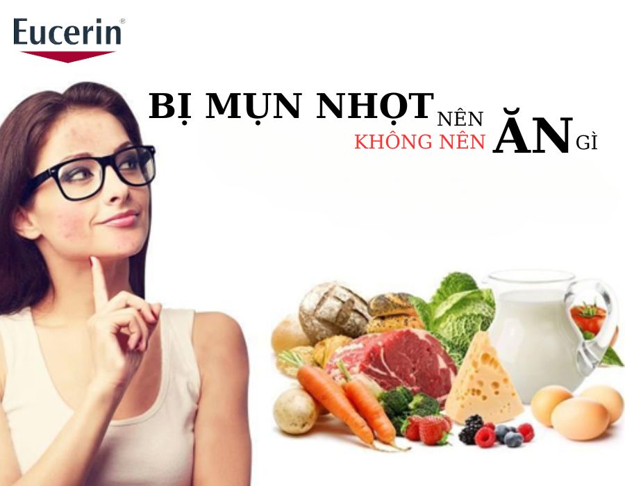 mụn nhọt nên kiêng ăn gì